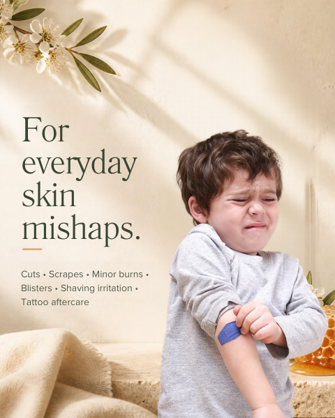 Honey for Healing Wound Cream for everyday skin mishaps