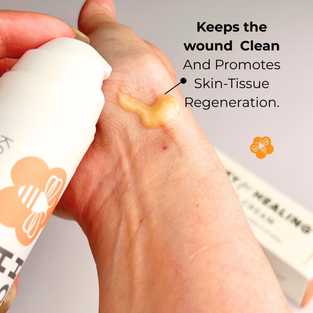 Honey for Healing® Powerful Manuka Wound Cream - Image 3