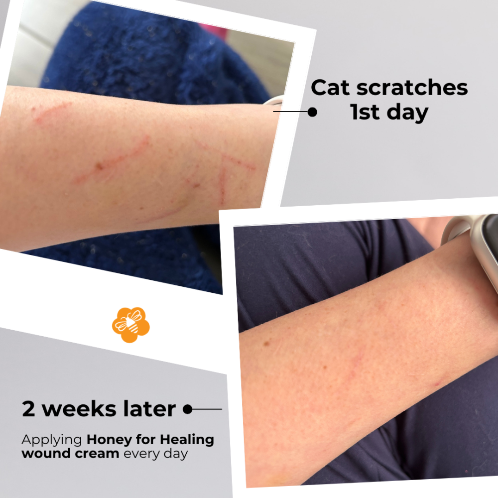 Honey for Healing® Powerful Manuka Wound Cream - Image 8